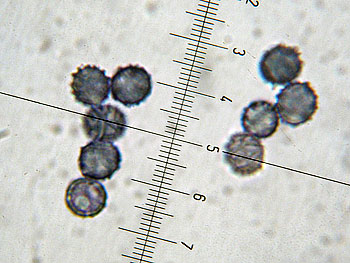 lact_subumbonatus_spore7 (31K)