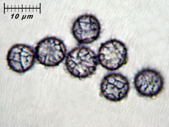 lactatlanticus_spore10 (26K)
