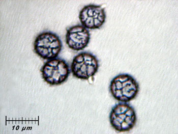 lactatlanticus_spore13 (33K)