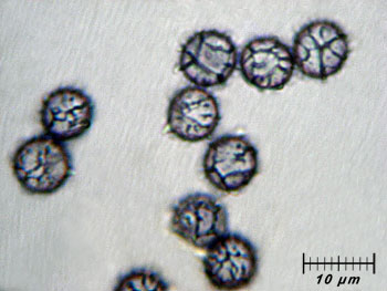 lactatlanticus_spore5 (25K)