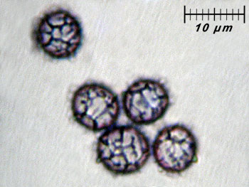 lactatlanticus_spore7 (24K)