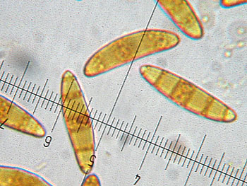 leotia_lubrica_spore2 (38K)
