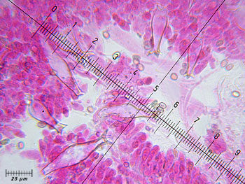 plutcervinus_pleuro5 (51K)