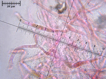 rusacrifolia_cutis1 (41K)