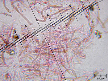 rusacrifolia_cutis5 (51K)