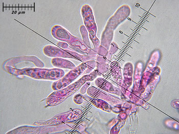 rusacrifolia_imenio4 (39K)