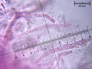 russtorulosa_cutis2 (36K)