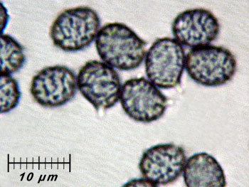 russtorulosa_spore12 (29K)