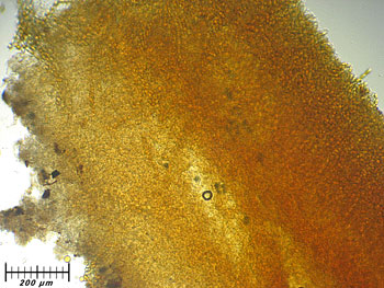 tarzettacatinus_excipulum1 (38K)