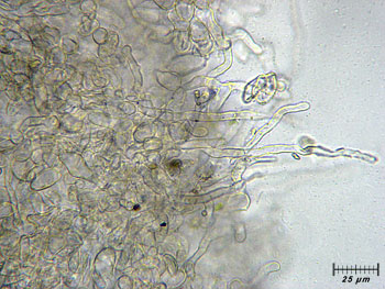 tarzettacatinus_excipulum4 (38K)