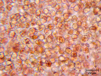 tremfoliacea_basidi1 (51K)
