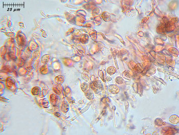 tremfoliacea_basidi2 (39K)