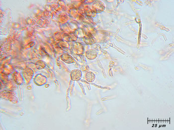 tremfoliacea_basidi3 (29K)