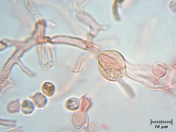 tremfoliacea_basidi6 (19K)