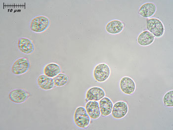 tremfoliacea_spore1 (16K)