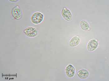 tremfoliacea_spore2 (11K)