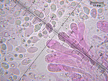 trichsulphureum_basidi1 (54K)