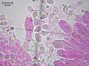 trichsulphureum_basidi2 (47K)