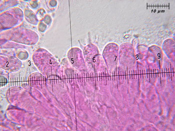 trichsulphureum_basidi3 (40K)