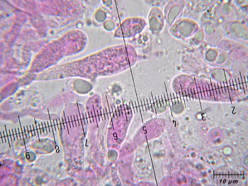 trichsulphureum_basidi4 (49K)