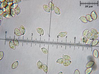 trichsulphureum_spore2 (37K)