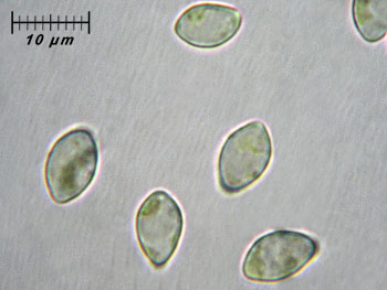 trichsulphureum_spore4 (31K)