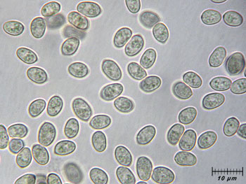 tubhiemalis_spore11 (31K)