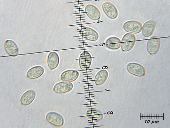 tubhiemalis_spore4 (31K)