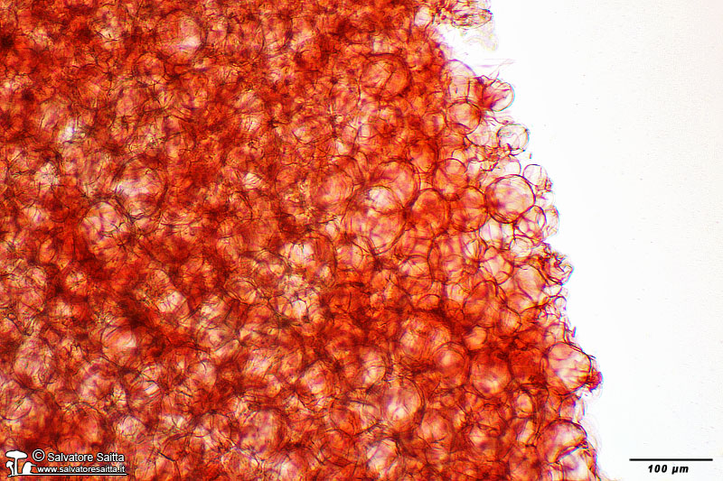 Peziza muscicola excipulum ectale foto 1
