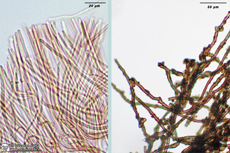 Plectania rhytidia parafisi e peli foto 1