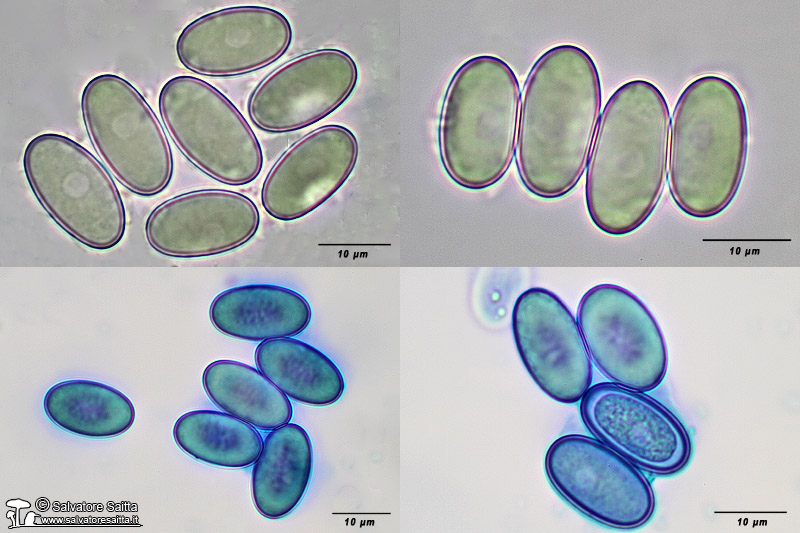 Pseudaleuria fibrillosa spore foto 1