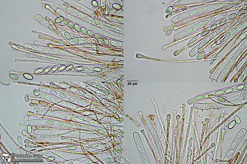 Pseudaleuria fibrillosa aschi e parafisi foto 1
