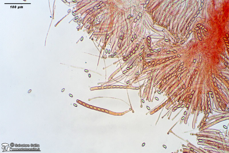 Pseudaleuria fibrillosa aschi e parafisi foto 2