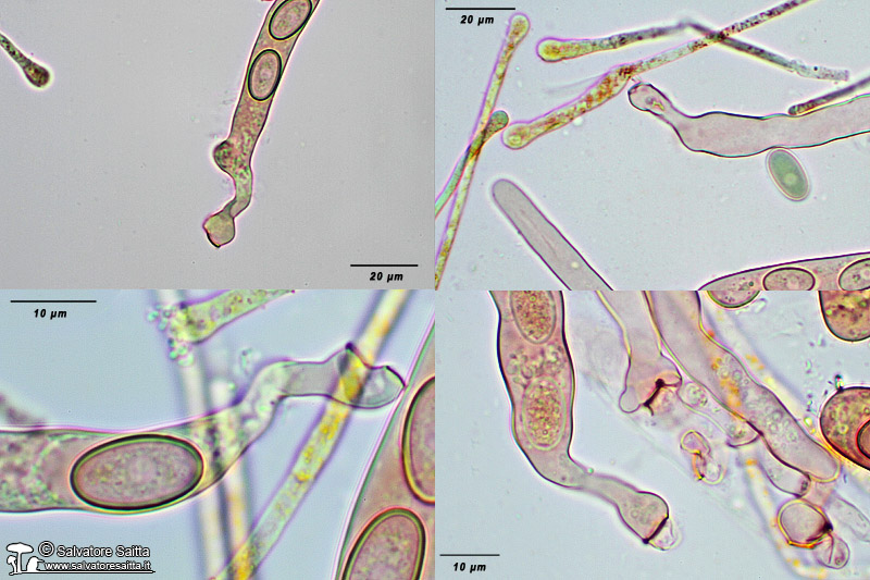 Pseudaleuria fibrillosa base degli aschi foto 1