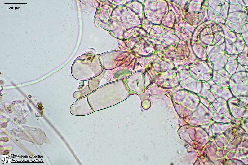 Pseudaleuria fibrillosa peli marginali foto 4