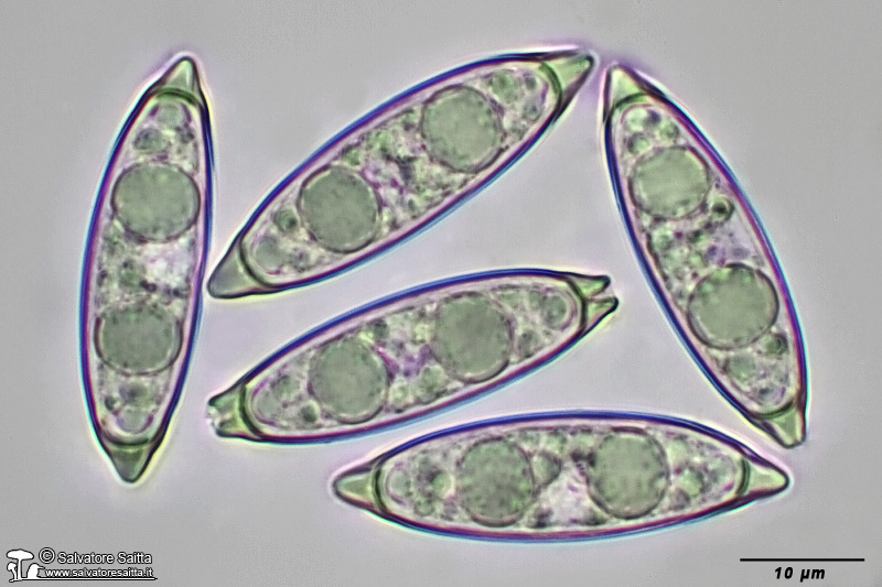 Rhizina undulata spore foto 1