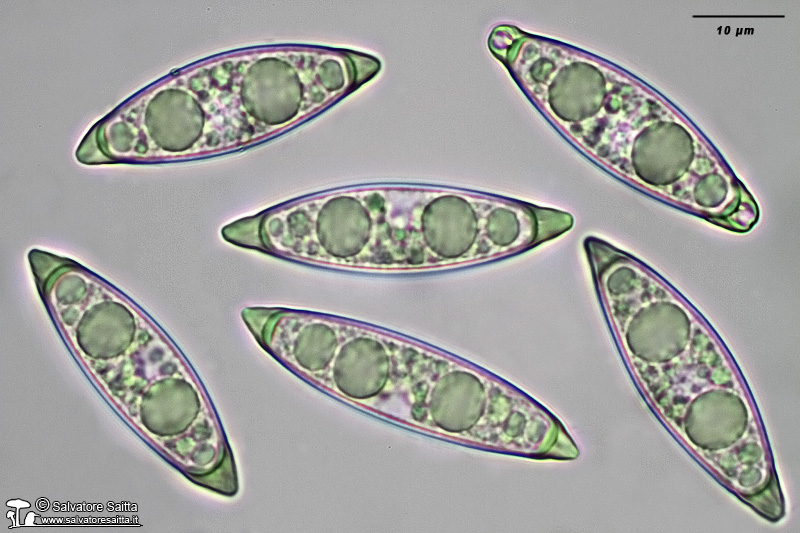 Rhizina undulata spore foto 2