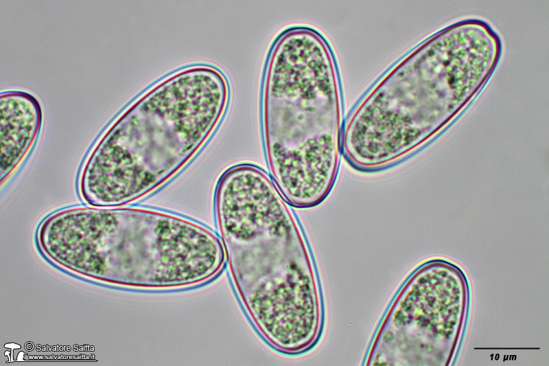 Sarcoscypha coccinea spore foto 6