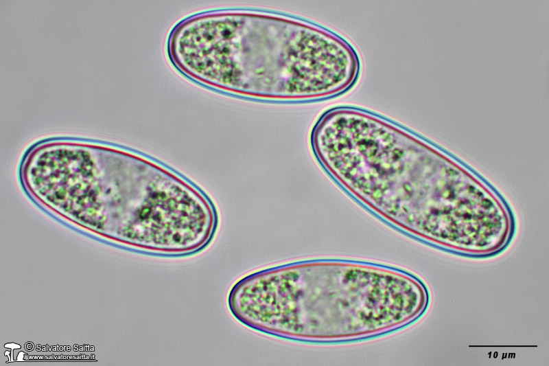 Sarcoscypha coccinea spore foto 7