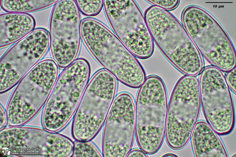 Sarcoscypha coccinea spore foto 8