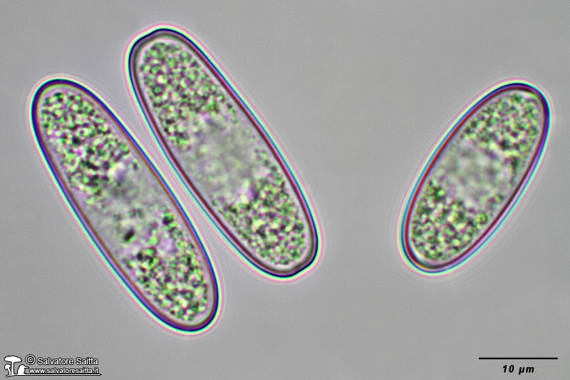 Sarcoscypha coccinea spore foto 9
