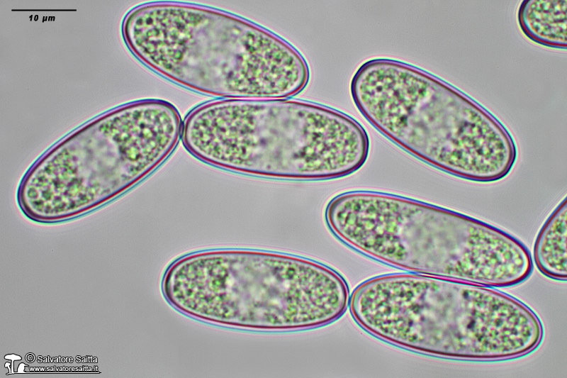 Sarcoscypha coccinea spore foto 10