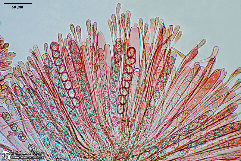 Scutellinia crinita aschi e parafisi foto 1