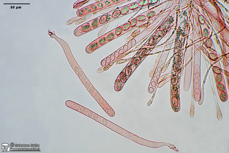 Scutellinia crinita aschi e parafisi foto 2