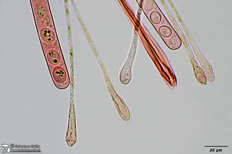 Scutellinia crinita aschi e parafisi foto 3