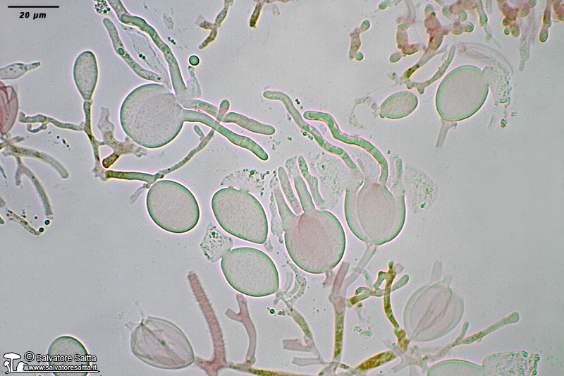 Tremella mesenterica elementi imeniali foto 2