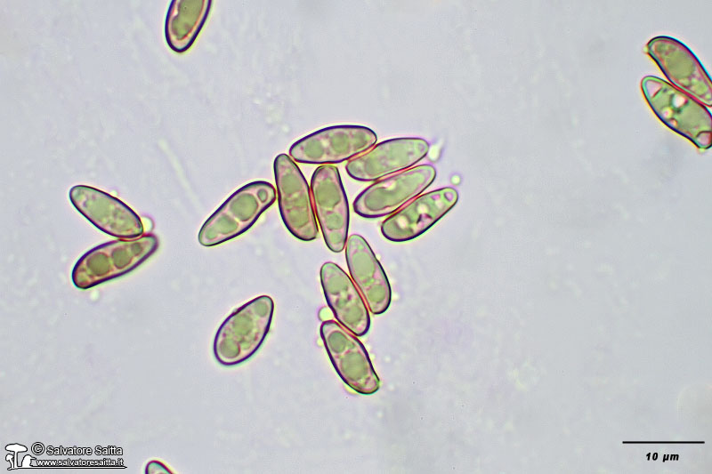 Rheubarbariboletus armeniacus spore foto 1