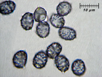 lactdeliciosus_spore3 (24K)