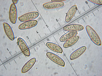 lecclepidum_spore3 (37K)