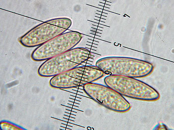 lecclepidum_spore4 (35K)